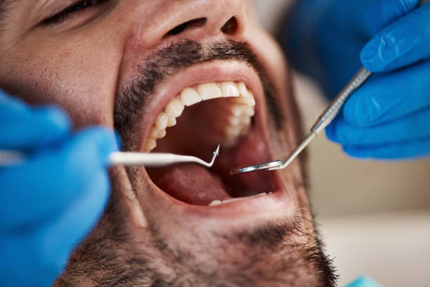 Best Emergency Broken Tooth Repair in Bowmanstown, PA